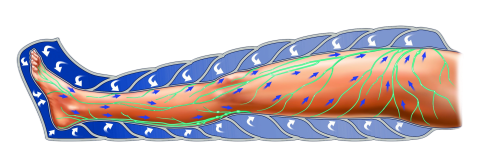 Как работает аппликатор для аппарата прессотерапии