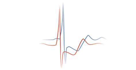 BTL-Cardiology_ECG_comparison