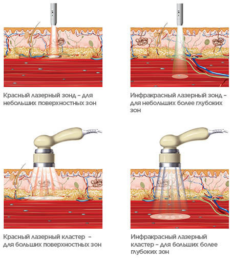 BTL-Laser-medical-background_RU