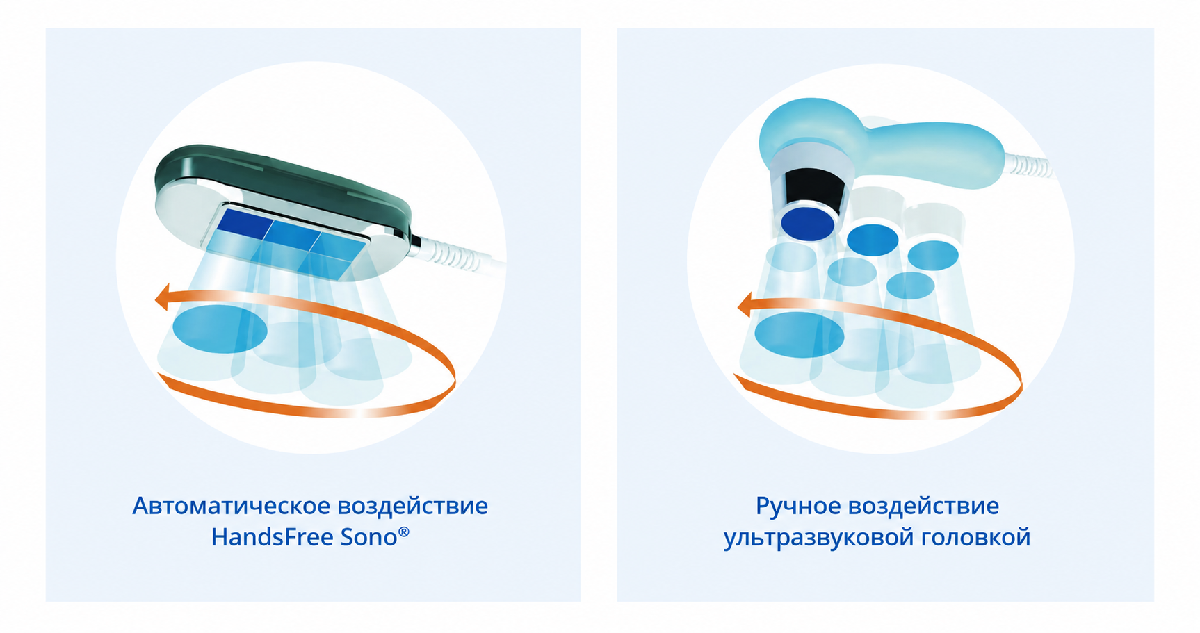 Сравнение HandsFree Sono® и ручного аппликатора