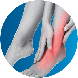 Bone_edema_ICON_130x130px_EN100