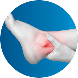 Posttraumatic_edema_ICON_130x130px_EN100