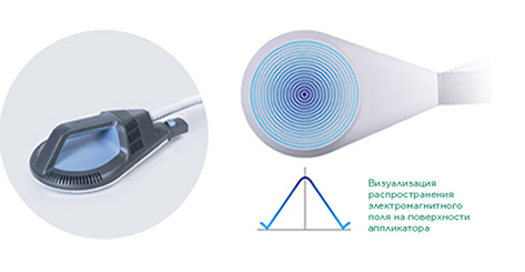 SIS-Focused-field-applicator_RU
