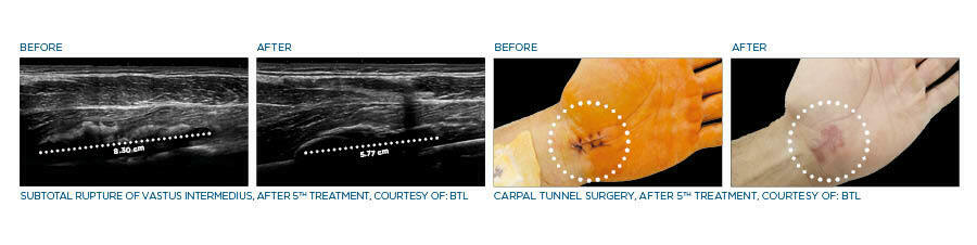 medical_background_web_banner_Robotic_scanning_system_before-after