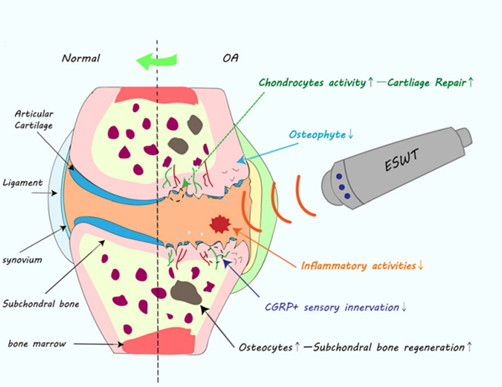 Что происходит в организме во время процедуры УВТ