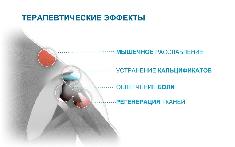 Терапевтические эффекты УВТ