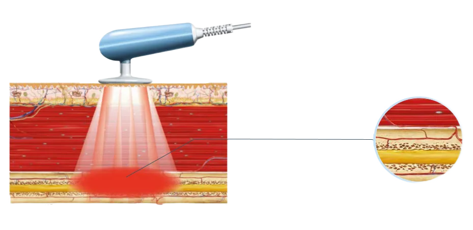 Емкостной режим