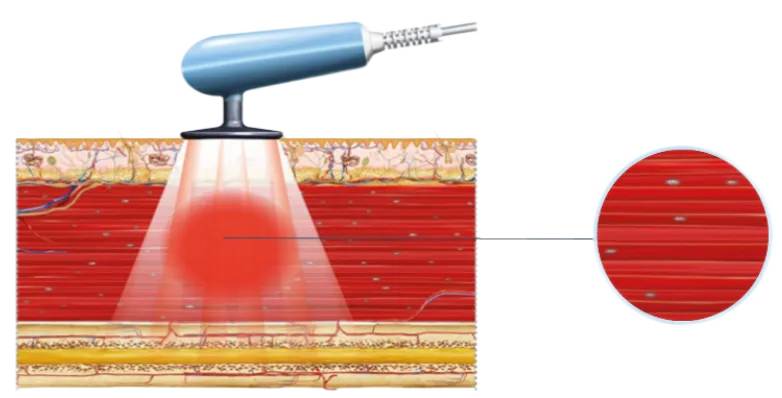 Емкостной режим