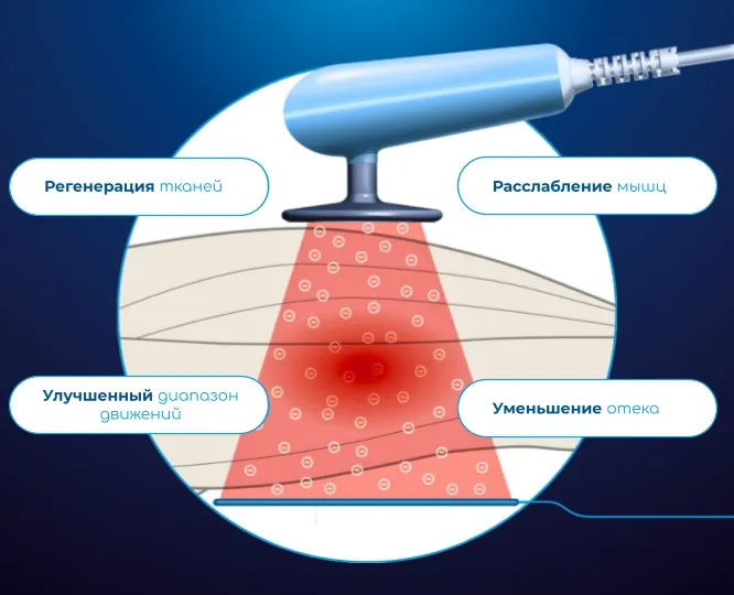 Механизм действия текар-терапии