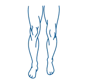 Роботикс для нижних конечностей